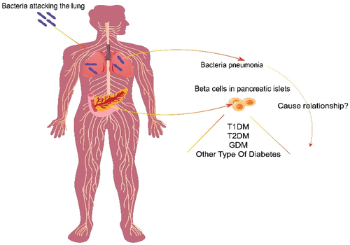 Figure 2. What the relationship between bacteria pneumonia and diabetes?.