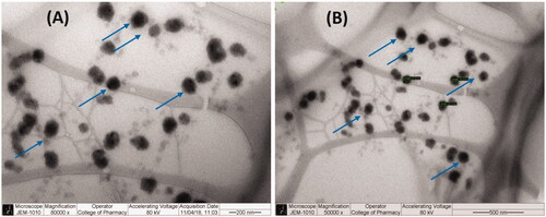 Figure 4. TEM micrographs of SN and DN loaded representative SNEDDS (BSO/CMCM/CrEL [15/35/50%w/w]). The arrows indicate the oil droplets.